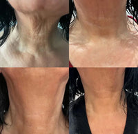 KRX Neck Lift Intensive Firming Neck Cream