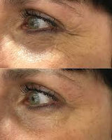 Rosy Drops Stretch Sheets Eye Patches