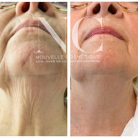 KRX Neck Lift Intensive Firming Neck Cream