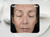 Vol.U.Lift - 4D Skin Rebound Complex 57gr. Image Skincare
